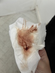 Bleeding at 14 weeks with a haematoma, has anyone experienced this?