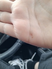 Convinced im going to die of rabies or prison