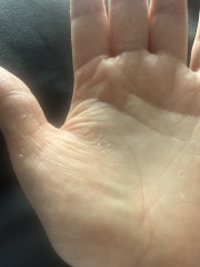 Dry hands... boy/girl