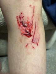 How to heal scrapes and grazes???