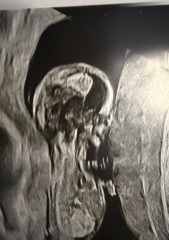 Can anyone guess baby’s sex from my 13 week scan however? Please read my message