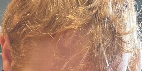 Strawberry blonde/ginger hair