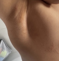 Unexplained rash? Can anyone identify the cause?