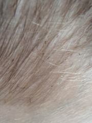 Do these black specks in my son's hair look like lice?