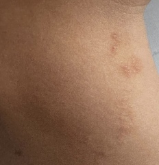 Unexplained rash? Can anyone identify the cause?