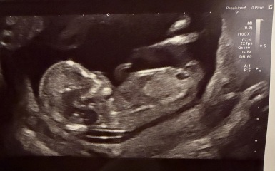 Nub Theory Gender Predictions please :-)