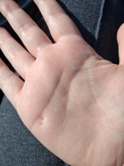 Convinced im going to die of rabies or prison