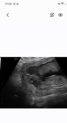 Gender scan guesses