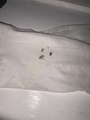 Passing tissue-like bits after a stretch and sweep in pregnancy