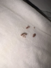Passing tissue-like bits after a stretch and sweep in pregnancy