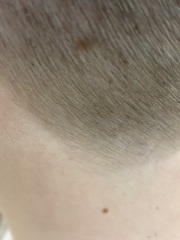 Do these black specks in my son's hair look like lice?