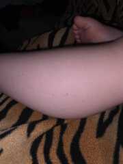 Spots