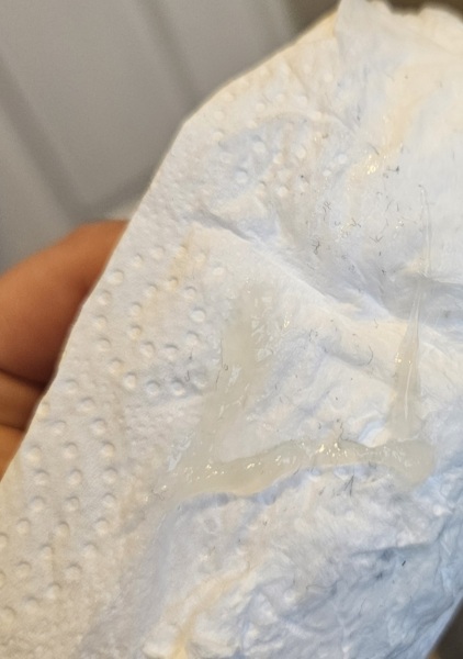 Mucus plug or normal discharge