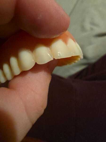 Anyone know anything about dentures? Help!