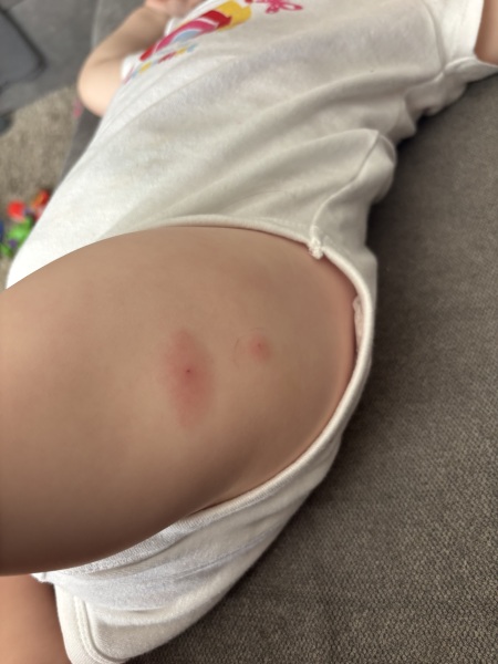 Immunisations