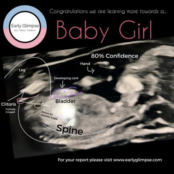 Has anyone found nub theory predictions accurate for baby sex?