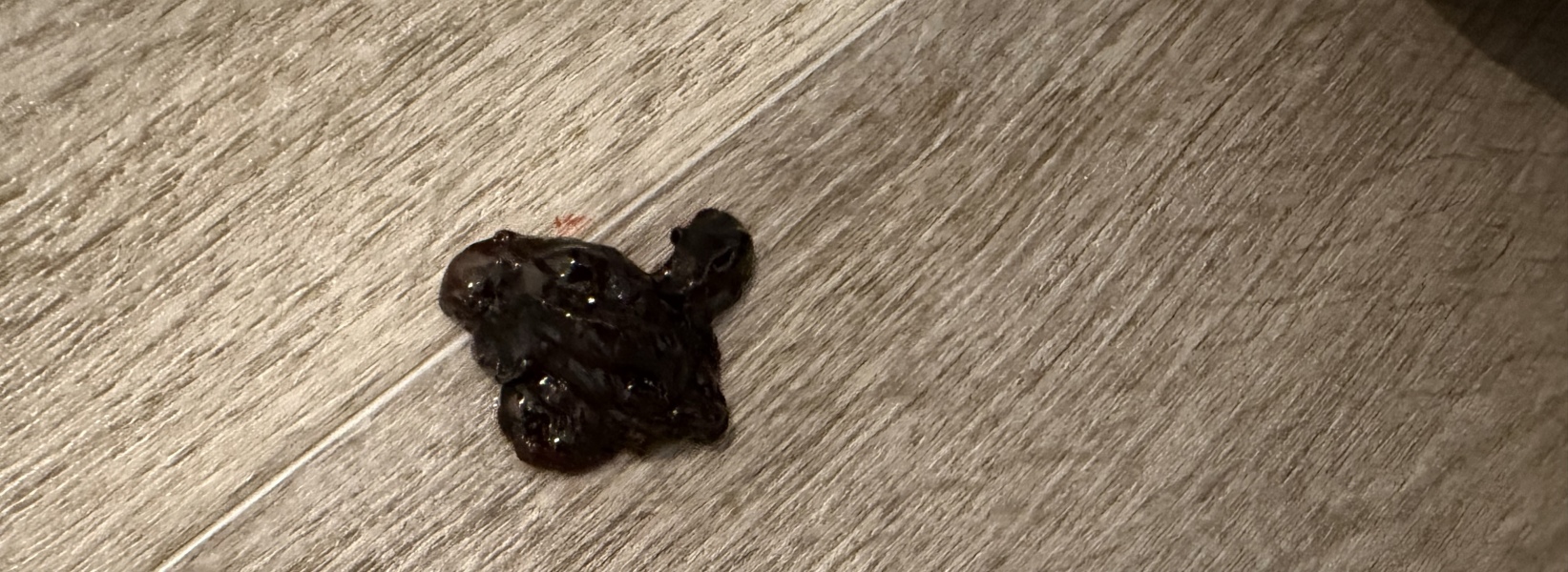 Blood trapped in womb after ERPC. Help!