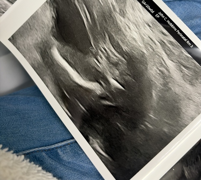 Ultrasound help!