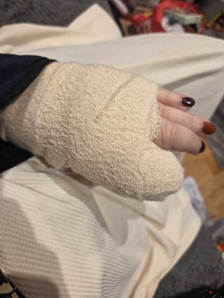 Finger amputation need a hand hold.