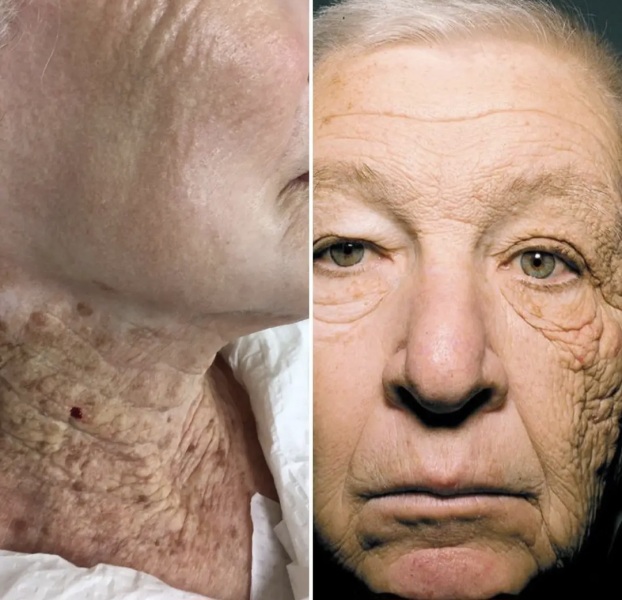 "Wear SPF every day! - is it a cult?