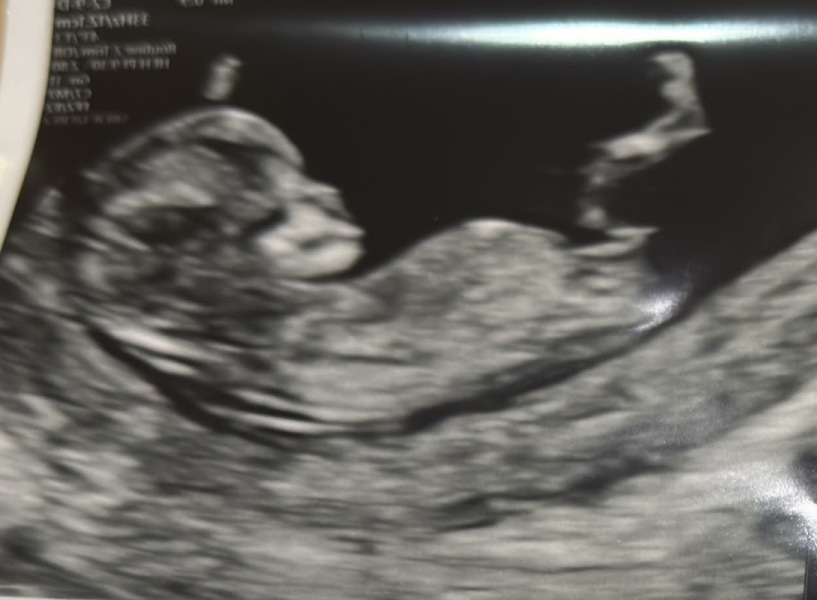 12+0 boy or girl? Confused!