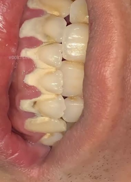 to think that dental hygienists are wildly overpriced