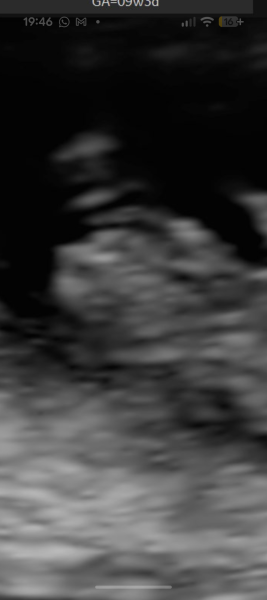 Girl or boy?