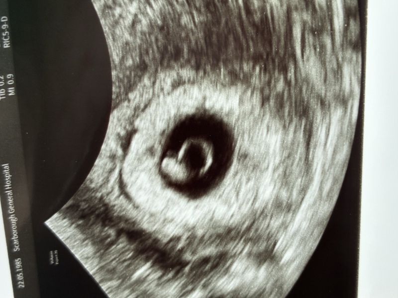 Any Mumma’s due in May 2027?