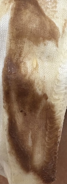 Brown discharge early pregnancy? tmi