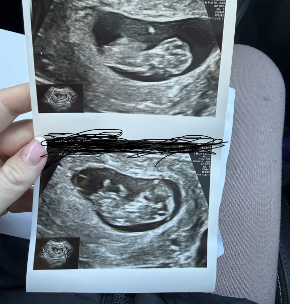 Gender 10+6