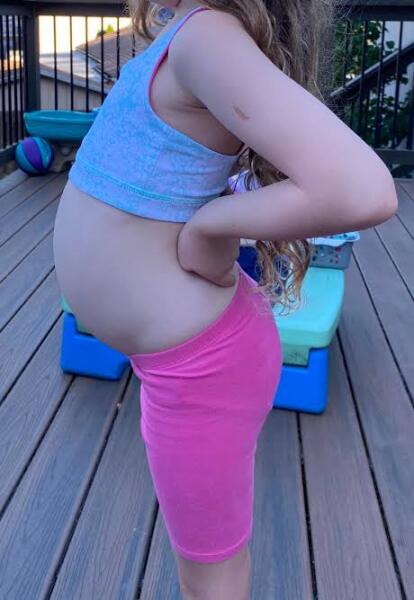 Bloated belly 7 yr old