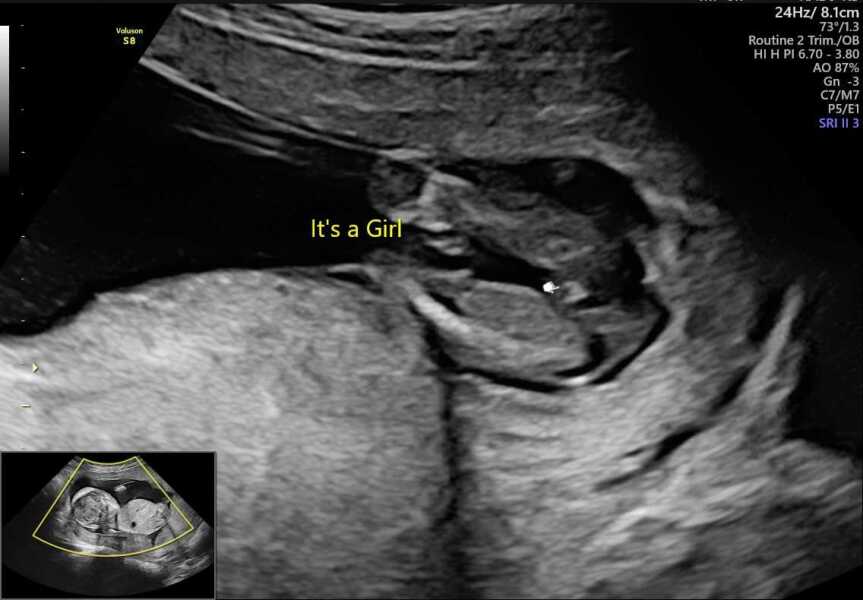 Gender Scan - Thoughts?