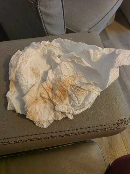 Implantation bleeding???