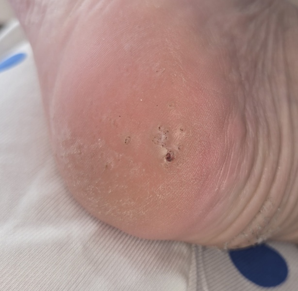 Wtf is going on with my foot?