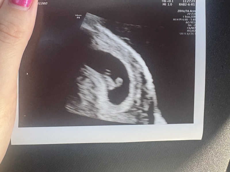 Any Mumma’s due in May 2027?