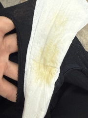 Overdue by three days with discharge after sweep and mucus plug