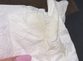TMI - has anybody experienced this before?