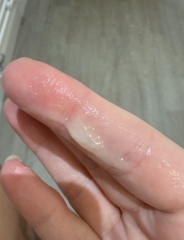 Cervical Mucus Post Ovulation