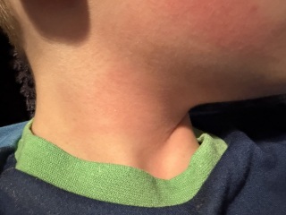 What’s this rash on my DS?