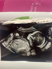 Side profile gender guesses!