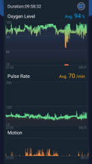 Experiences of sleep apnea