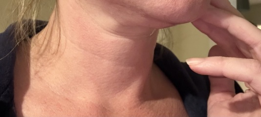 TURKEY NECK HELP