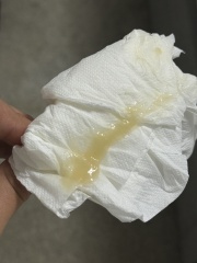 Overdue by three days with discharge after sweep and mucus plug