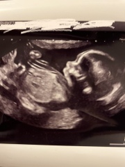 Side profile gender guesses!