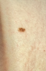 Do you think this could be cancerous?