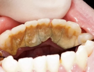 to think that dental hygienists are wildly overpriced