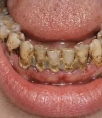 to think that dental hygienists are wildly overpriced