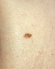 Do you think this could be cancerous?