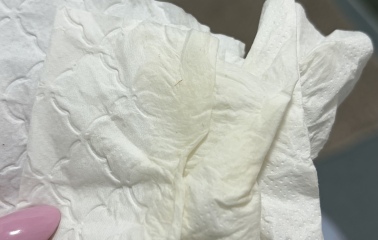 TMI - has anybody experienced this before?