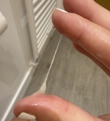 Cervical Mucus Post Ovulation